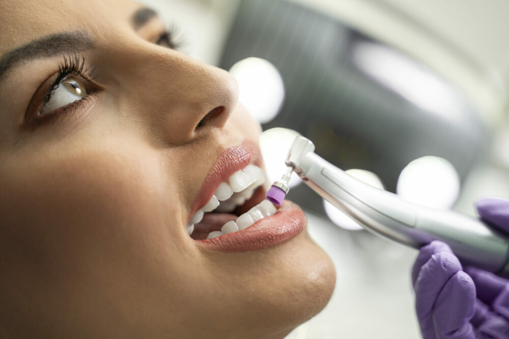 What Happens During Professional Teeth Cleaning?